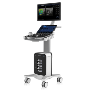 Cart-Based Ultrasound